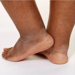 CeraVe Healing Ointment, Moisturizing Petrolatum Skin Protectant For Dry Skin Unscented - 3oz -Body Care Shop GUEST 08ef367d 1b61 41c0 b835 5f7759581190