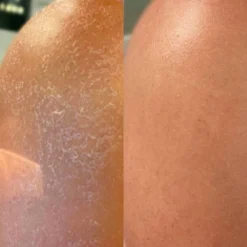 Kopari Jumbo Ultra Restore Body Butter - 12oz - Ulta Beauty -Body Care Shop GUEST 8047ccc9 d333 4fd2 b934 510a92122d56